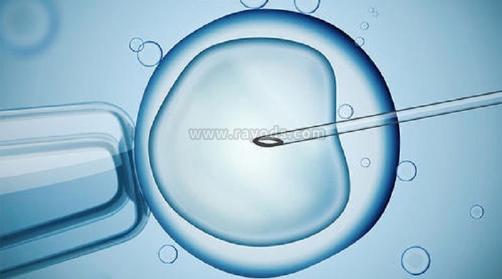 由郑州试管婴儿专家卡明帕塔博士创立的试管婴
