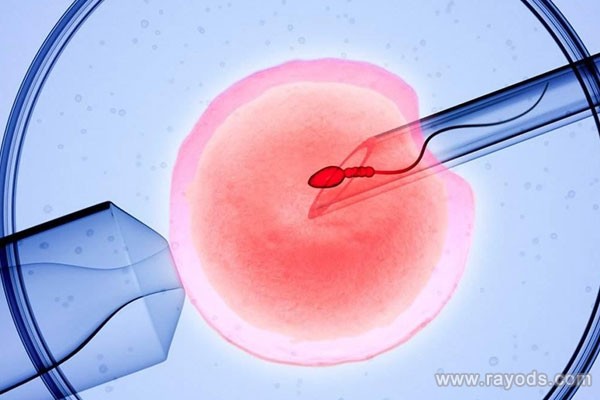 在郑州试管婴儿过程中，染色体正常的情况下，