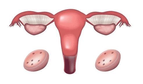 子宫内膜薄，如何在试管婴儿移植前改善它