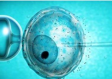 郑州合法二代试管婴儿生殖中心:无精子症的诊断是什么？